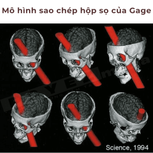 hộp sọ của Gage