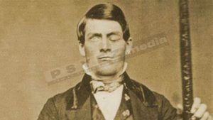 Phineas Gage